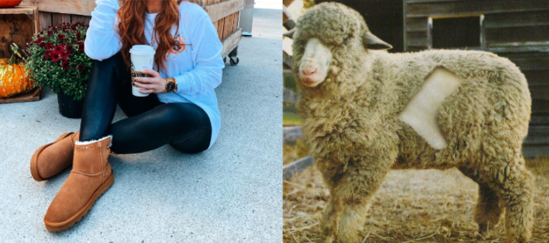 UGGs aesthetic vs. reality