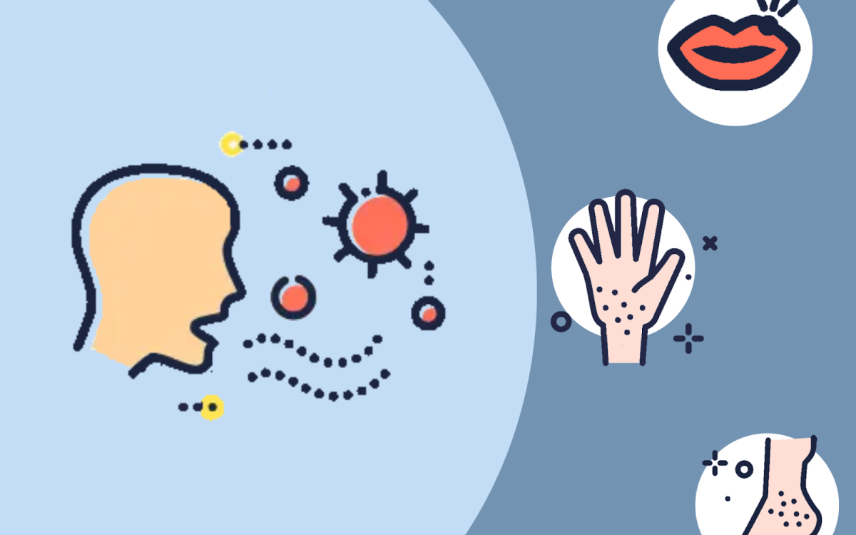Hand, Foot, and Mouth Disease circulates Mills
